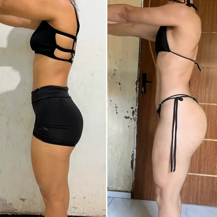 Antes e depois de aluna do LFTEAM